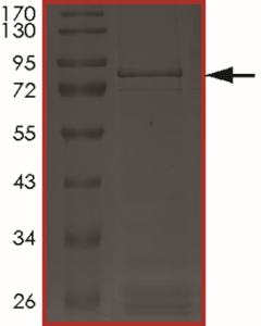 EGFR (D770_N771insGF) Protein