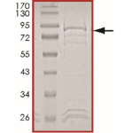 EGFR (H773_V774insAH) Protein