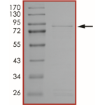 EGFR (H773_V774insH) Protein