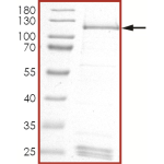 HER2 (L755S) Protein