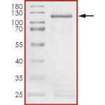 HER2 (L755W) Protein