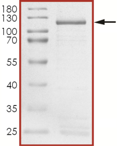 HER2 (L755W) Protein
