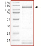 HER2 (D769H), Active