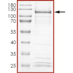 HER2 (V777L), Active