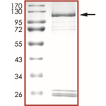 HER2 (L785F), Active