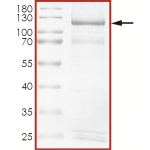 HER2 (A775_G776insYVMA), Active
