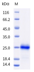 Recombinant Human GITR