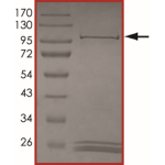 JAK1 (E966V) Protein