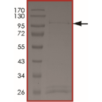 JAK1 (d966-989) Protein
