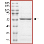 JAK1 (JH2 domain) Protein