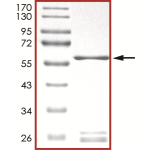 MEK3 (MAP2K3), Unactive