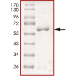 MEK6 (MAP2K6), Unactive