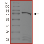 MET (D1228G), Active