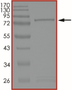 MET (D1228V), Active