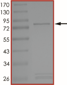 MET (D1228Y), Active