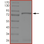 MET (V1092I), Active