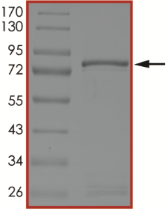 MET (V1092I), Active