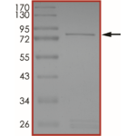 MET (Y1230S), Active