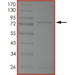 MET (H1094L), Active
