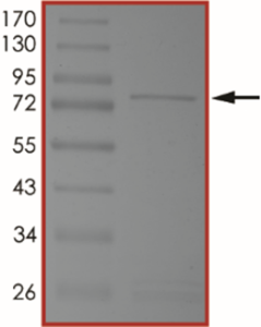 MET (H1094L), Active