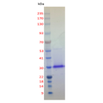 Plasmodium vivax Lactate Dehydrogenase (Pv-LDH) - His-Tagged
