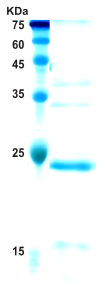 Epstein-Barr Virus (EBV) VCA p18 protein (detection)