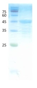 Deamidated gliadin peptide antigen Deamidated gliadin peptide antigen