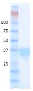 Human hemoglobin variant S