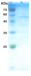 HIV-2 gag p26 protein