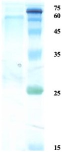 Herpes simplex virus Type 1 (HSV-1) glycoprotein G Herpes simplex virus Type 1 (HSV-1) glycoprotein G