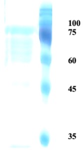 Herpes simplex virus Type 2 (HSV-2) glycoprotein G Herpes simplex virus Type 2 (HSV-2) glycoprotein G