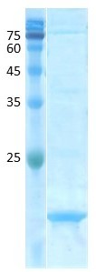 Aspergillus fumigatus (asp f 1)