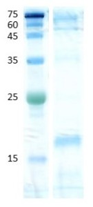 Dermatophagoides farinae (der f 2)