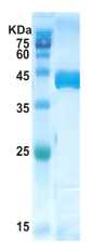 Trypanosoma cruzi chimeric chagas protein (capture)