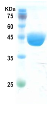 Chikungunya capsid protein