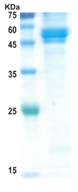 Chikungunya mutant envelope E1 protein (insect cell)