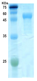 Cytomegalovirus (CMV) pp 52 (UL44) protein