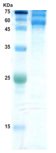 Dengue type 1 envelope protein (insect cell) Dengue type 1 envelope protein (insect cell)