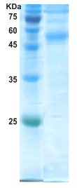 Dengue type 2 envelope protein (insect cell) Dengue type 2 envelope protein (insect cell)