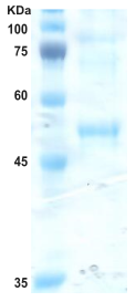 Dengue type 3 envelope protein (insect cell) Dengue type 3 envelope protein (insect cell)
