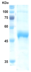 Dengue type 3 NS1 protein (insect cell) Dengue type 3 NS1 protein (insect cell)