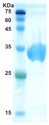 Hepatitis C virus (HCV) NS3 protein (AA1192-1457) Hepatitis C virus (HCV) NS3 protein (AA1192-1457)