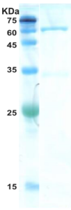 HIV-1 gag p24 protein HIV-1 gag p24 protein