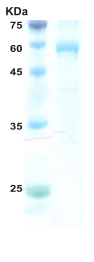 HIV-2 envelope gp36 protein (52 kDa) (capture) HIV-2 envelope gp36 protein (52 kDa) (capture)