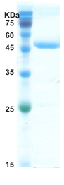 HIV-1 envelope gp120/gp41 protein (capture) HIV-1 envelope gp120/gp41 protein (capture)