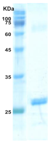 HIV-1 gag p24 protein HIV-1 gag p24 protein