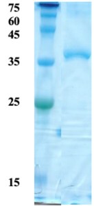 HTLV-2 envelope gp21 protein HTLV-2 envelope gp21 protein
