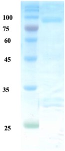 Helicobactor pylori (H. pylori) UreB protein Helicobactor pylori (H. pylori) UreB protein