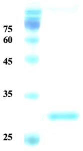 Plasmodium vivax merozoite surface protein 1 (capture)