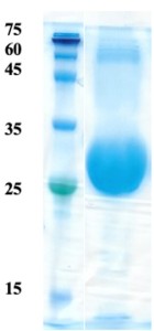 Plasmodium falciparum merozoite surface protein 1 (detection)